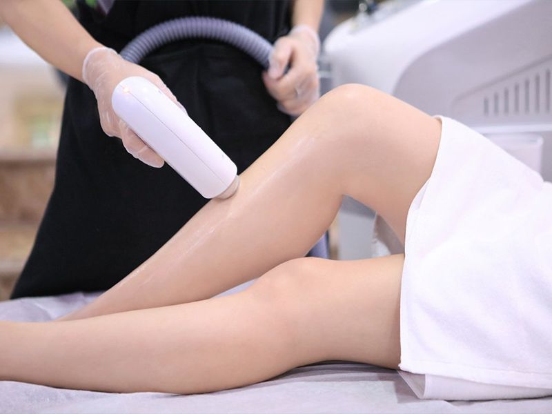 Triệt lông công nghệ cao - giải pháp hiện đại cho làn da mịn màng